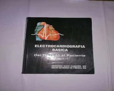 Electrocardiografia Basica del trazado al paciente