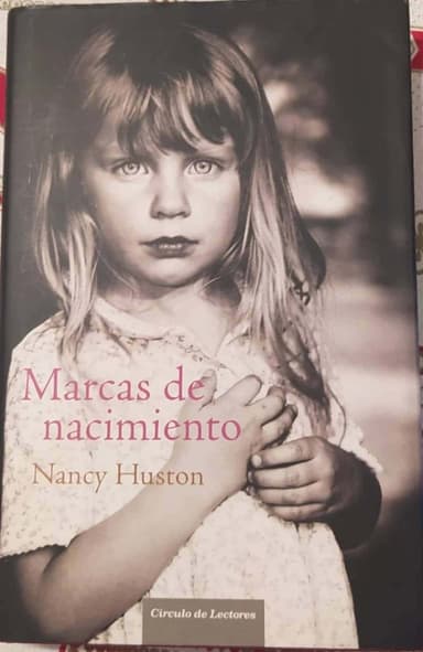marcas de nacimiento