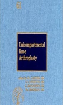 Unicompartmental knee arthroplasty